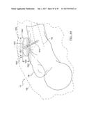 Method And Apparatus For Surgical Navigation diagram and image