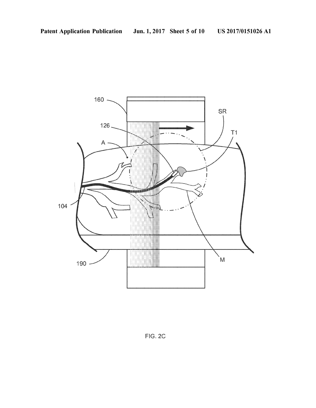 Systems and Methods for Robotic Medical System Integration With External     Imaging - diagram, schematic, and image 06