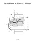 Systems and Methods for Robotic Medical System Integration With External     Imaging diagram and image