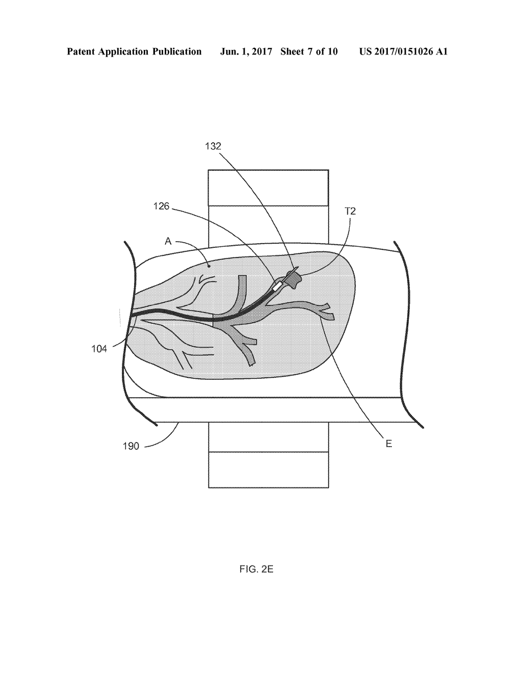 Systems and Methods for Robotic Medical System Integration With External     Imaging - diagram, schematic, and image 08