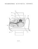 Systems and Methods for Robotic Medical System Integration With External     Imaging diagram and image