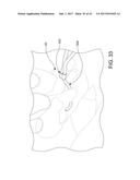 CATHETERS, CATHETER SYSTEMS, AND METHODS FOR PUNCTURING THROUGH A TISSUE     STRUCTURE AND ABLATING A TISSUE REGION diagram and image