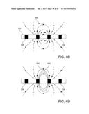 CATHETERS, CATHETER SYSTEMS, AND METHODS FOR PUNCTURING THROUGH A TISSUE     STRUCTURE AND ABLATING A TISSUE REGION diagram and image