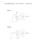 ORTHODONTIC ARCHWIRE WITH VARIABLE CROSS SECTIONAL CONFIGURATION diagram and image