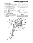 Method for Optimization of Joint Arthroplasty Component Design diagram and image