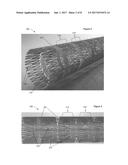 STENTS HAVING A HYBRID PATTERN AND METHODS OF MANUFACTURE diagram and image