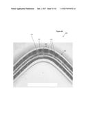 STENTS HAVING A HYBRID PATTERN AND METHODS OF MANUFACTURE diagram and image