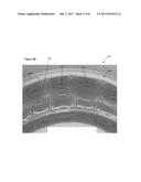 STENTS HAVING A HYBRID PATTERN AND METHODS OF MANUFACTURE diagram and image