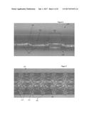 STENTS HAVING A HYBRID PATTERN AND METHODS OF MANUFACTURE diagram and image