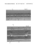 STENTS HAVING A HYBRID PATTERN AND METHODS OF MANUFACTURE diagram and image