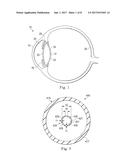 DEVICES, SYSTEMS, AND METHODS FOR TIP VACUUM CONTROL DURING ASPIRATION diagram and image