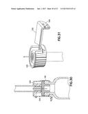 SHORT INJECTION LENGTH SYRINGE diagram and image