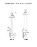 SHORT INJECTION LENGTH SYRINGE diagram and image