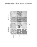 COMPOSITION AND METHOD FOR TREATING OR PREVENTING SKELETAL MUSCLE FIBROSIS diagram and image