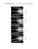 THE USE OF DEXTRAN SULFATE HAVING AN AVERAGE MOLECULAR WEIGHT BELOW 10000     DA FOR INDUCING ANGIOGENESIS IN A SUBJECT diagram and image