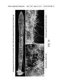 COMPOSITIONS AND METHODS FOR PREPARING AN INJECTABLE MEDIUM  FOR     ADMINISTRATION INTO THE CENTRAL NERVOUS SYSTEM diagram and image