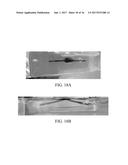 COMPOSITIONS AND METHODS FOR PREPARING AN INJECTABLE MEDIUM  FOR     ADMINISTRATION INTO THE CENTRAL NERVOUS SYSTEM diagram and image