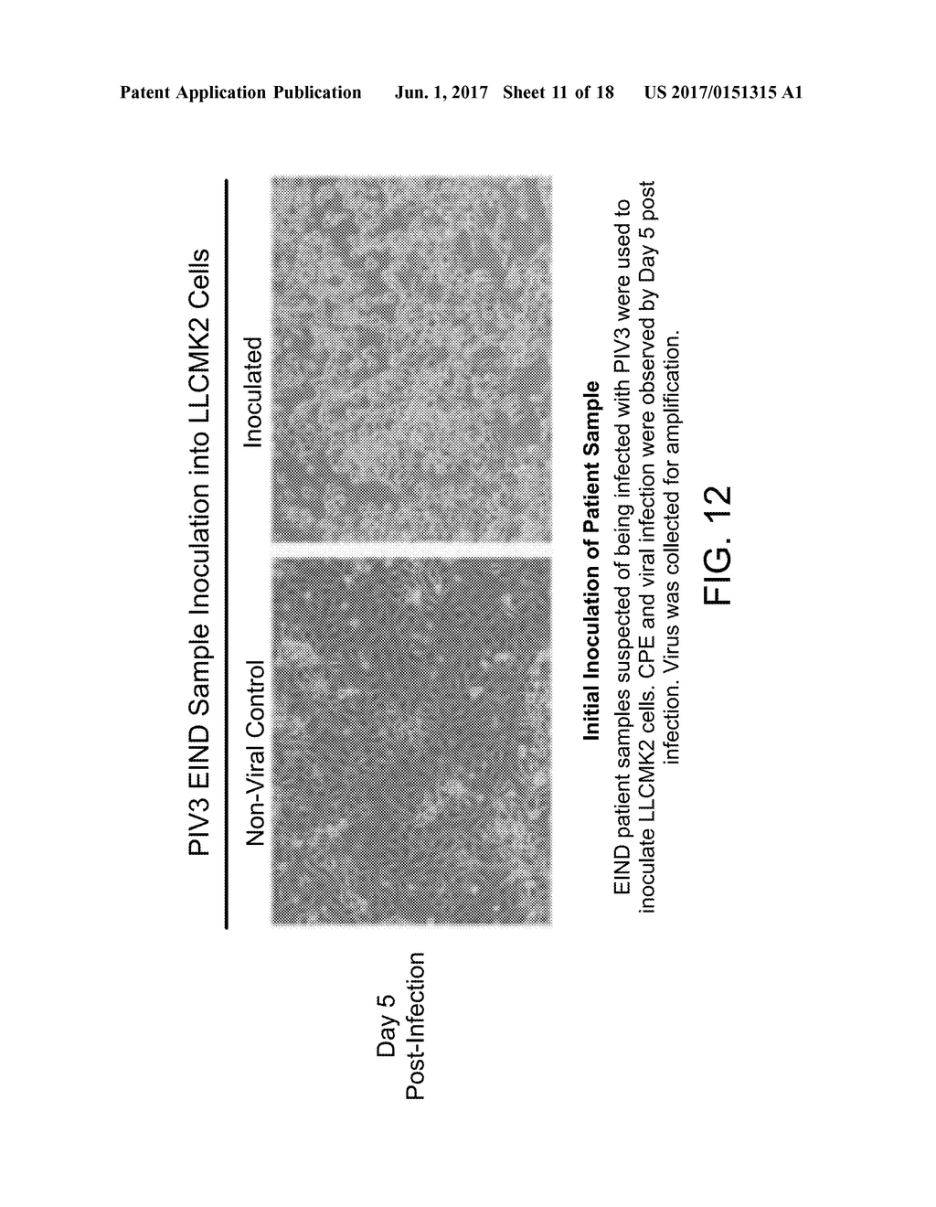 Methods, Compounds and Compositions for Treatment of Influenza and     Parainfluenza Patients - diagram, schematic, and image 12