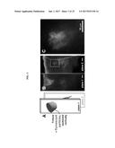 ULTRASOUND DELIVERY OF NANOPARTICLES diagram and image