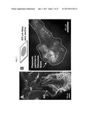 ULTRASOUND DELIVERY OF NANOPARTICLES diagram and image