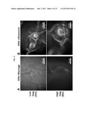 ULTRASOUND DELIVERY OF NANOPARTICLES diagram and image