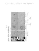 ULTRASOUND DELIVERY OF NANOPARTICLES diagram and image