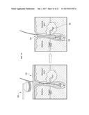 ULTRASOUND DELIVERY OF NANOPARTICLES diagram and image