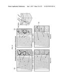 ULTRASOUND DELIVERY OF NANOPARTICLES diagram and image