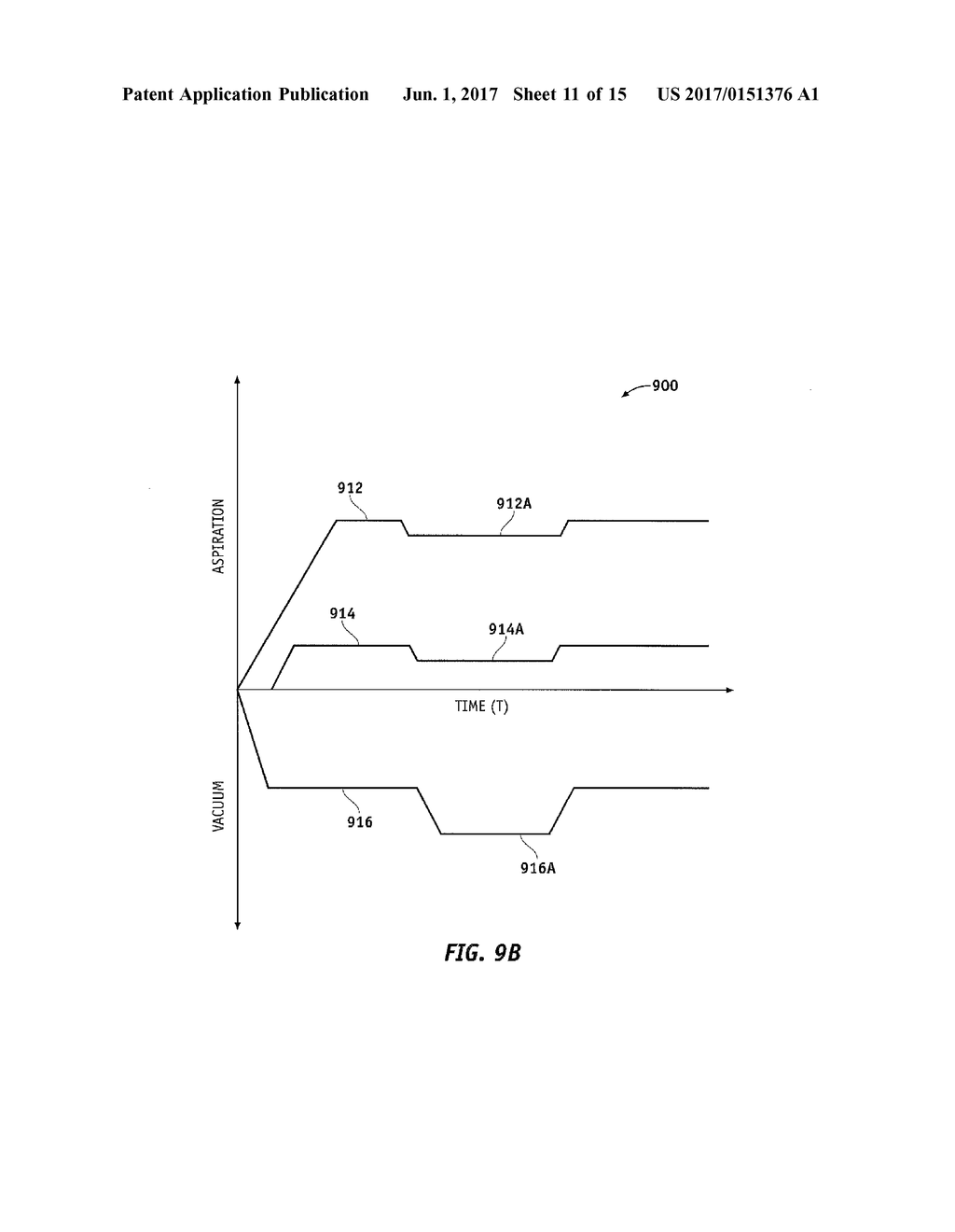 AUTOMATICALLY SWITCHING DIFFERENT ASPIRATION LEVELS AND/OR PUMPS TO AN     OCULAR PROBE - diagram, schematic, and image 12