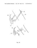 A device and a method for providing resuscitation or suspended state in     cardiac arrest diagram and image