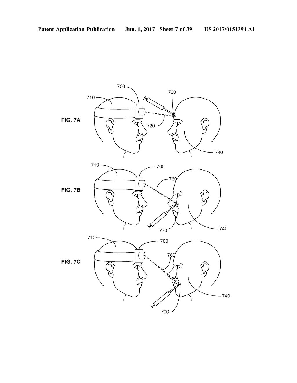 Systems and Methods for Guiding Injections - diagram, schematic, and image 08