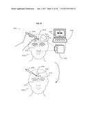 Systems and Methods for Guiding Injections diagram and image