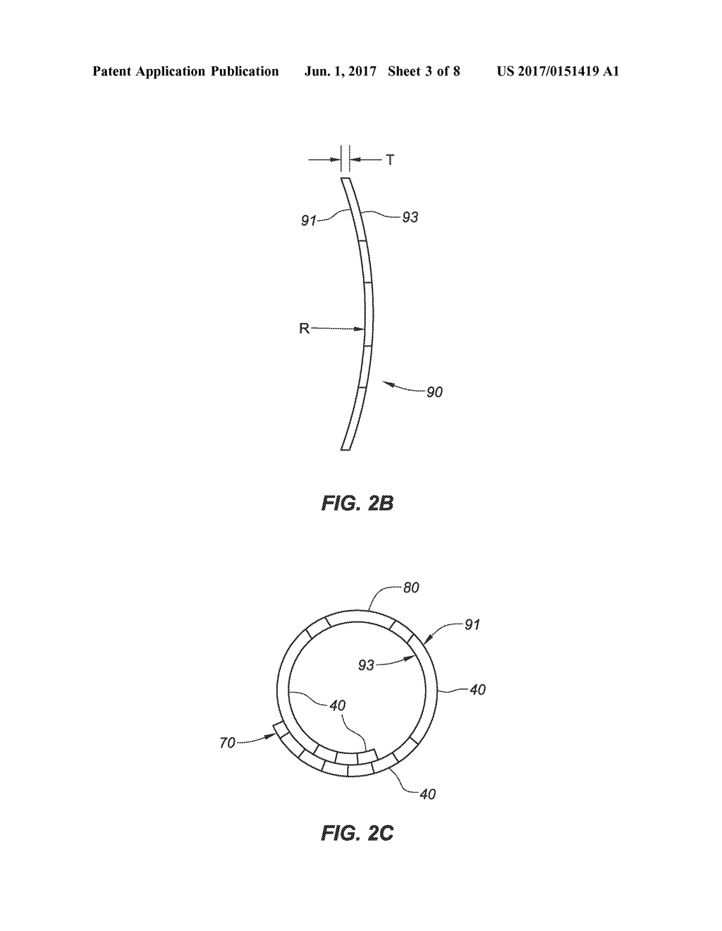 NEEDLE DEVICES WITH BISTABLE STRUCTURE AND RELATED METHODS - diagram, schematic, and image 04