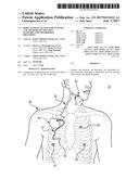 PERCUTANEOUS ACCESS FOR SYSTEMS AND METHODS OF TREATING SLEEP-RELATED     DISORDERED BREATHING diagram and image