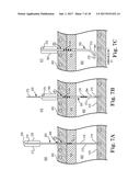 PERCUTANEOUS ACCESS FOR SYSTEMS AND METHODS OF TREATING SLEEP-RELATED     DISORDERED BREATHING diagram and image