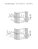 PERCUTANEOUS ACCESS FOR SYSTEMS AND METHODS OF TREATING SLEEP-RELATED     DISORDERED BREATHING diagram and image