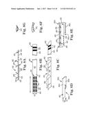 PERCUTANEOUS ACCESS FOR SYSTEMS AND METHODS OF TREATING SLEEP-RELATED     DISORDERED BREATHING diagram and image