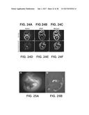 ENGINEERING OF HUMANIZED CAR T-CELL AND PLATELETS BY GENETIC     COMPLEMENTATION diagram and image