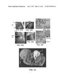 ENGINEERING OF HUMANIZED CAR T-CELL AND PLATELETS BY GENETIC     COMPLEMENTATION diagram and image