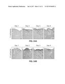 METHODS AND APPARATUS FOR MONITORING WOUND HEALING USING IMPEDANCE     SPECTROSCOPY diagram and image