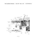 SYSTEMS AND METHODS FOR CREATING AN EFFECT USING MICROWAVE ENERGY TO     SPECIFIED TISSUE diagram and image