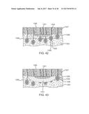 SYSTEMS AND METHODS FOR CREATING AN EFFECT USING MICROWAVE ENERGY TO     SPECIFIED TISSUE diagram and image