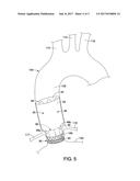 ENDOLUMINAL PROSTHESIS COMPRISING A VALVE AND AN AXIALLY EXTENDABLE     SEGMENT diagram and image