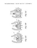 PROSTHETIC IMPLANT DELIVERY DEVICE WITH INTRODUCER CATHETER diagram and image