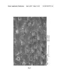 SURFACE-REACTED CALCIUM CARBONATE FOR DESENSITIZING TEETH diagram and image