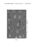 SURFACE-REACTED CALCIUM CARBONATE FOR DESENSITIZING TEETH diagram and image