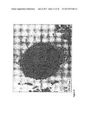 PROGENITOR CELLS FROM WHARTON S JELLY OF HUMAN UMBILICAL CORD diagram and image