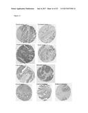 ANTIBODIES BINDING AXL diagram and image