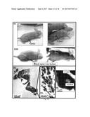 TREATMENT OF CANCER OR TUMOR INDUCED BY THE RELEASE OF HEAT GENERATED BY     VARIOUS CHAINS OF MAGNETOSOMES EXTRACTED FROM MAGNETOTACTIC BACTERIA AND     SUBMITTED TO AN ALTERNATING MAGNETIC FIELD diagram and image