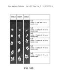 COMPOSITIONS AND METHODS FOR REDUCING OVERDOSE diagram and image